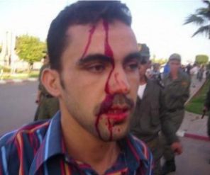 Image.manifestant.blessé.par.force.répression.Mrrkch.(12.2012)