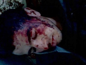 محمد الفزازي، طالب، ضربه البوليس ضربة قاتلة على الرأس، في 25 يناير 2013.ء